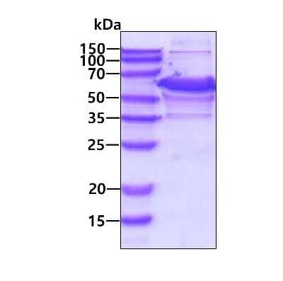 SDS-PAGE: Recombinant Human ETS2 His Protein [NBP2-51752]